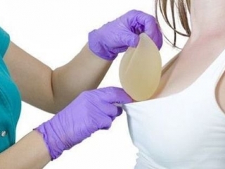 Dịch vụ Phẫu Thuật Nâng Cấp Vòng 1 tại Thẩm Mỹ HUỲNH PHÁT