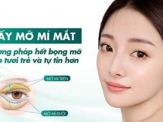 Bạn có biết: Khi nào cần lấy mỡ thừa ở mí mắt trên?