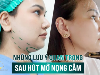 Hút Mỡ Nọng Cằm - Loại Bỏ Mỡ Thừa Tạo Cằm V-line và Những Điều Lưu ý Quan Trọng
