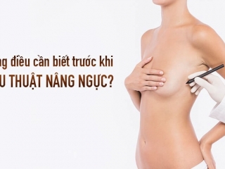 Nâng cấp vòng 1 – Những điều bạn cần biết