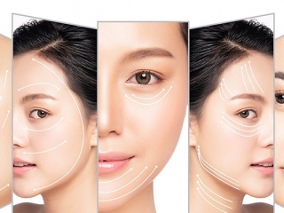 Căng da mặt bằng phẫu thuật có giúp trẻ vĩnh viễn không?