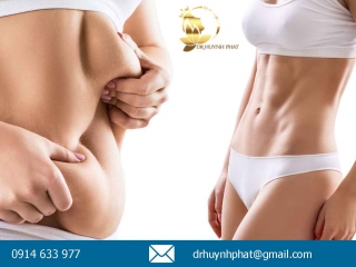 Hút Mỡ Điêu Khắc Body là gì? - 5 lưu ý cần tư vấn từ Bác sĩ Huỳnh Phát