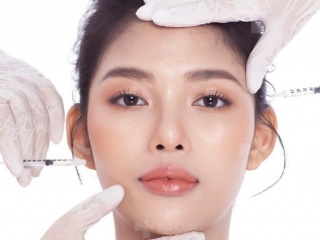 Tiêm Filler cân chỉnh tạo hình 
