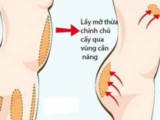 Dịch vụ phẫu thuật thẩm mỹ công nghệ cao - Viện thẩm mỹ Dr.Huỳnh Phát