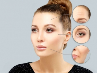 Tiêm Botox xoá nhăn