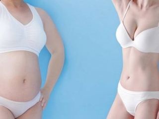 Hút mỡ bụng có thật sự hiệu quả? Việc hút mỡ bụng có ảnh hưởng gì không ?