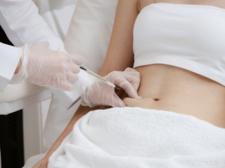 Hút Mỡ Bụng Không Phẫu Thuật: Giải Pháp Giảm Mỡ An Toàn Và Hiệu Quả