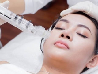 Tiêm căng bóng da được bao lâu ? Những điều bạn cần biết về phương pháp này
