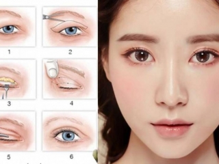 Viện thẩm mỹ Dr.Huỳnh Phát - nơi uy tín thực hiện dịch vụ thẩm mỹ vùng hàm mặt