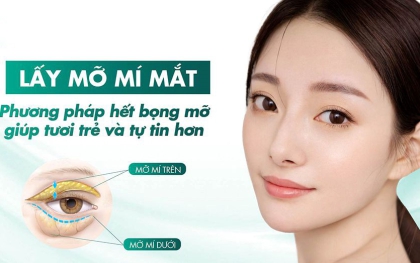 Bạn có biết: Khi nào cần lấy mỡ thừa ở mí mắt trên?