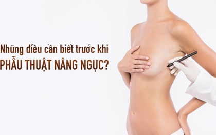Nâng cấp vòng 1 – Những điều bạn cần biết