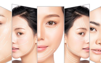 Căng da mặt bằng phẫu thuật có giúp trẻ vĩnh viễn không?