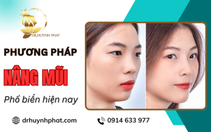 Tổng hợp các phương pháp nâng mũi phổ biến, được nhiều người lựa chọn hiện nay