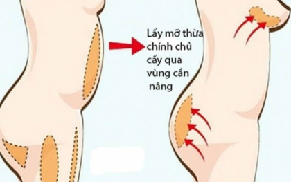 Dịch vụ phẫu thuật thẩm mỹ công nghệ cao - Viện thẩm mỹ Dr.Huỳnh Phát