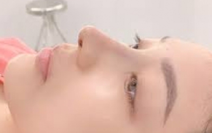 Nâng mũi sụn Surgiform có thần kỳ như lời đồn?