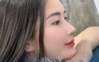 Nâng Mũi Cấu Trúc: Giải Pháp Kiến Tạo Dáng Mũi Đẹp Hoàn Hảo