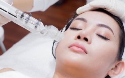 Tiêm căng bóng da được bao lâu ? Những điều bạn cần biết về phương pháp này