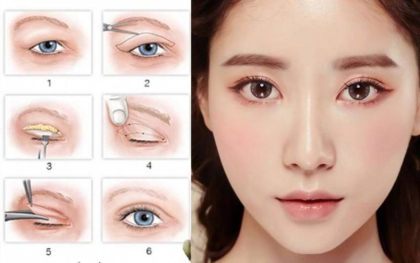 Viện thẩm mỹ Dr.Huỳnh Phát - nơi uy tín thực hiện dịch vụ thẩm mỹ vùng hàm mặt